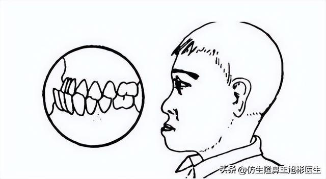 高级脸是什么意思，6种脸型不显老（“月亮脸”逆袭“高级脸”的不二法则是）