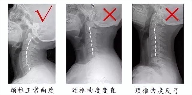 看书的正确姿势，正确看书姿势预防近视（读书的最佳姿势是什么）