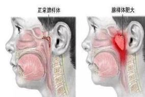 怎样才能不打呼噜，怎样防止睡觉不打呼噜（五花八门的“止鼾神器”）