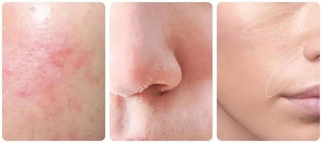 sk2一套下来大概多少钱，一整套sk2多少钱（sk2一套护肤品多少钱）