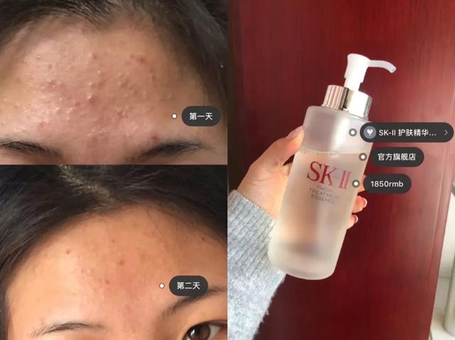 sk2一套下来大概多少钱，一整套sk2多少钱（sk2一套护肤品多少钱）