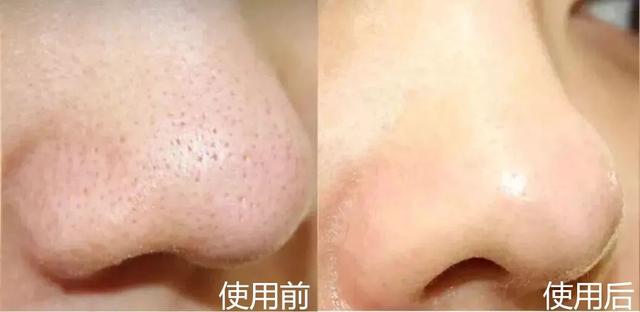 sk2一套下来大概多少钱，一整套sk2多少钱（sk2一套护肤品多少钱）