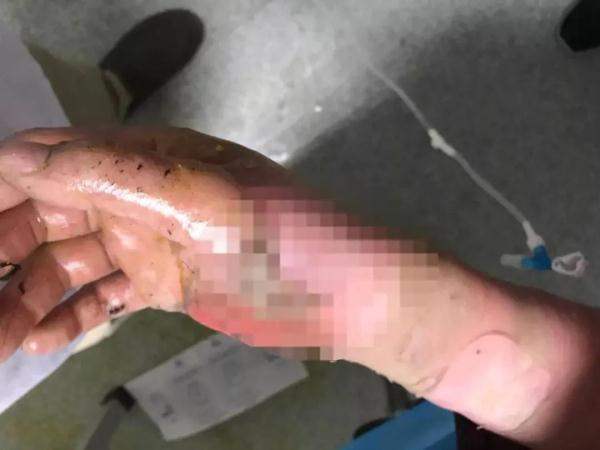 上热搜！这种数据线一定要换