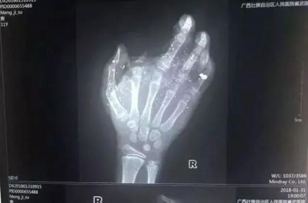 上热搜！这种数据线一定要换