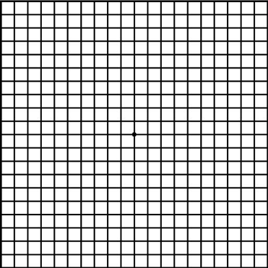 右下眼皮跳是什么预兆，眼皮跳是什么预兆（左眼皮跳是什么预兆）