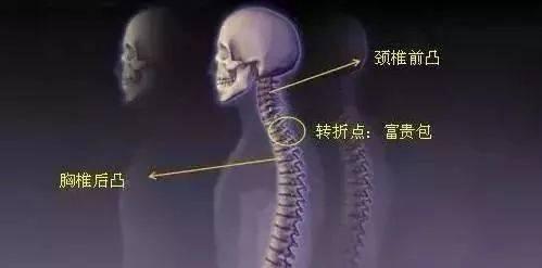 什么是富贵包，不仅仅是“包”那么简单