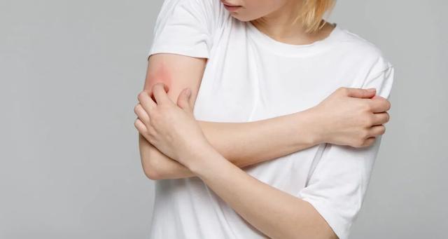 湿疹是什么样子的图片，宝宝长湿疹是什么样子（湿疹，不潮湿也会得）