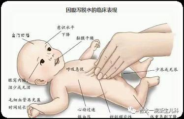 婴儿腹泻有哪些症状的，什么是婴儿腹泻症状（宝宝拉肚子怎么办）