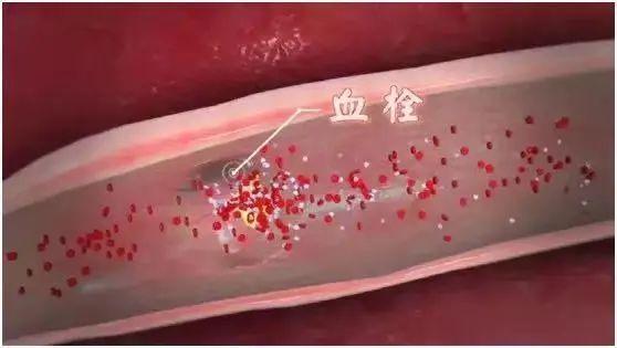 怀孕可以吃花生吗，孕妇可以吃花生吗（和胃、润肺、利血管…降低多种疾病风险）