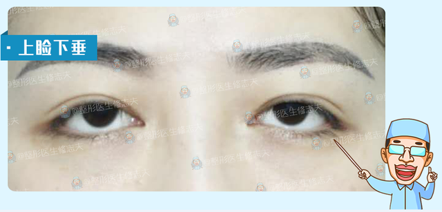 三白眼什么意思，什么是三白眼（原来下三白眼不只是天生的）
