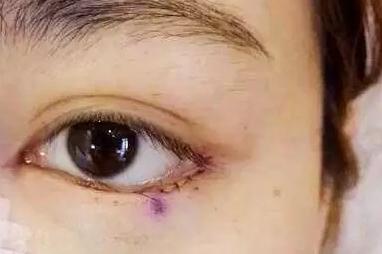 三白眼什么意思，什么是三白眼（原来下三白眼不只是天生的）