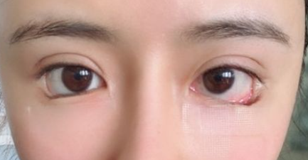 三白眼什么意思，什么是三白眼（原来下三白眼不只是天生的）