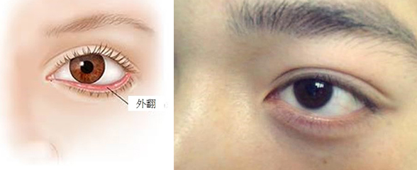 三白眼什么意思，什么是三白眼（原来下三白眼不只是天生的）