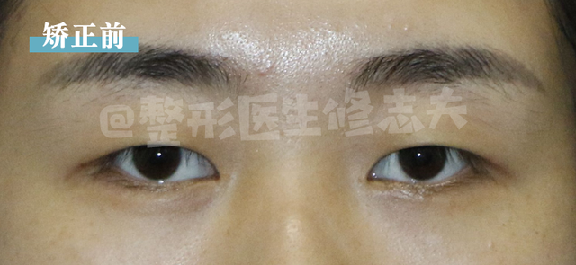 三白眼什么意思，什么是三白眼（原来下三白眼不只是天生的）