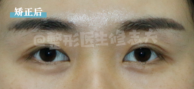 三白眼什么意思，什么是三白眼（原来下三白眼不只是天生的）