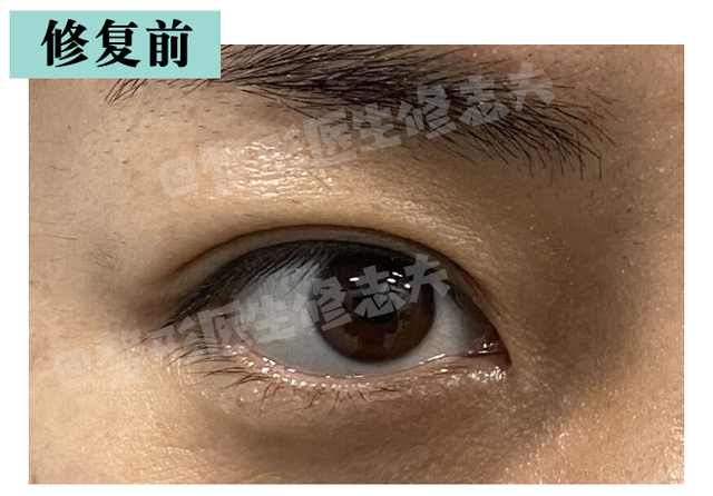 三白眼什么意思，什么是三白眼（原来下三白眼不只是天生的）