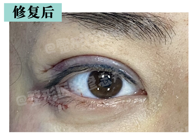 三白眼什么意思，什么是三白眼（原来下三白眼不只是天生的）
