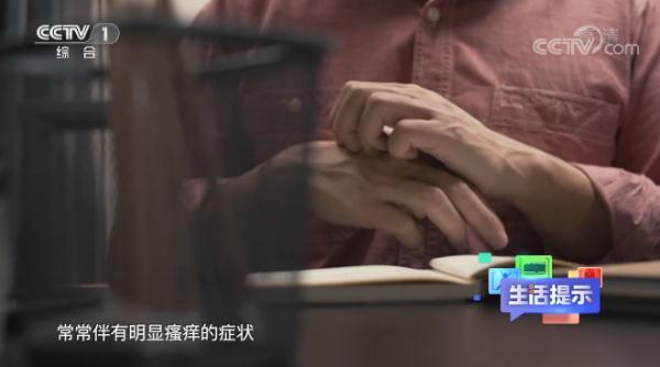 手掌脱皮是什么原因，手掌脱皮是什么原因用什么药（我的手到底“惹了谁”）