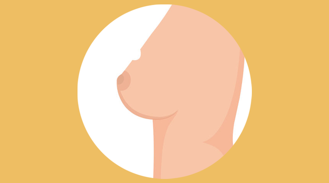 乳房的形状分为6种，从侧面观察（是正常现象还是疾病的信号）