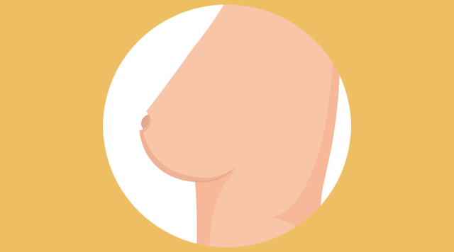 乳房的形状分为6种，从侧面观察（是正常现象还是疾病的信号）