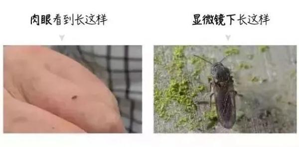 蠓虫叮咬后的症状图，蠓虫叮咬后的图（有人被咬后进急诊）