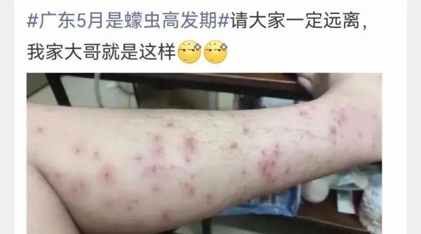 芝麻粒如何快速获取，如何快速获得芝麻粒有九种方法（有人被咬后进急诊……）