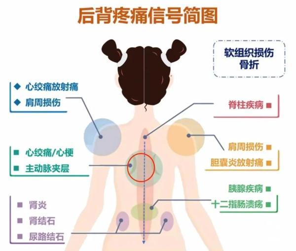 背部肌肉分布图，牛的背阔肌位置图片（后背疼与多种病有关）