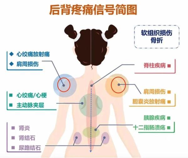 背部肌肉分布图，牛的背阔肌位置图片（后背疼与多种病有关）