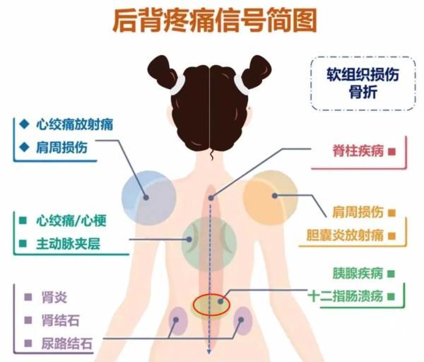 背部肌肉分布图，牛的背阔肌位置图片（后背疼与多种病有关）