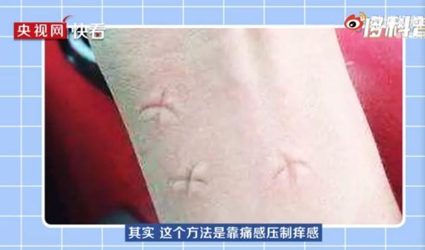 什么血型最招蚊子，什么血型最招蚊子咬?原来一点关系都没有（原来蚊子最爱的不是O型血）