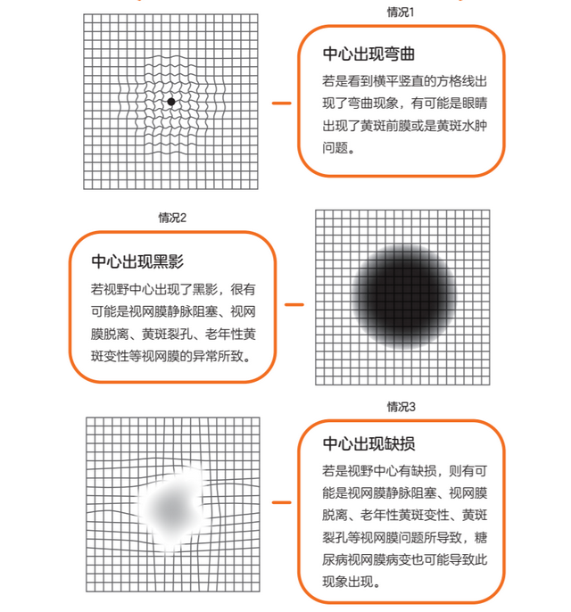 黄色加黑色变什么色（关于眼睛与视力的基础知识丨爱眼日）