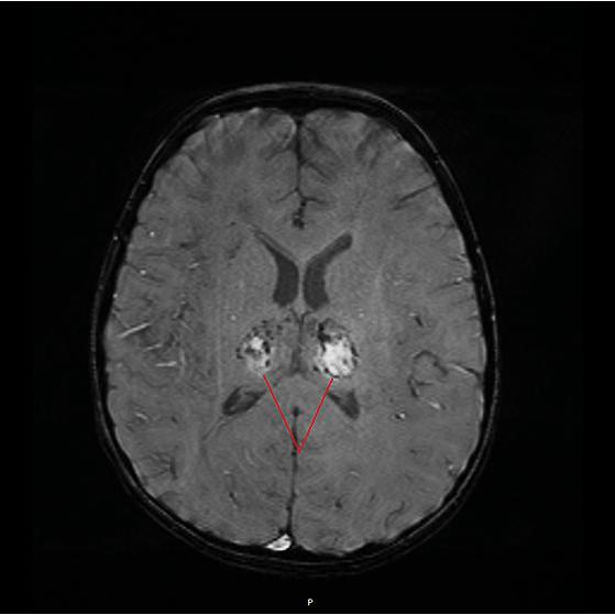 人昏迷最多不能超过多长时间，老人临终会昏睡多久（5岁娃“中招”后昏迷17天）