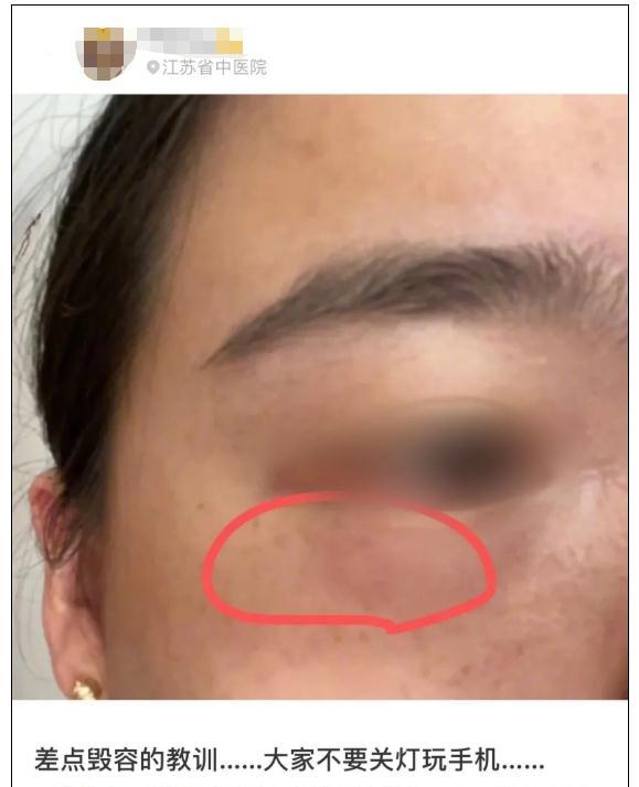 隐翅虫咬人后图片，隐翅虫咬后最有效的处理方法（这种虫子，毒液堪比硫酸）