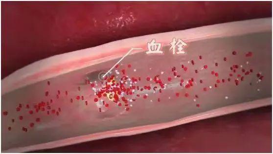 如何挑选鸡蛋是否新鲜，鸡蛋怎么挑比较新鲜（很多人第一步就错了）