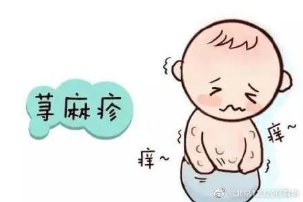 宝宝急性荨麻疹，小儿急性荨麻疹介绍（急性和慢性荨麻疹有明显区别）