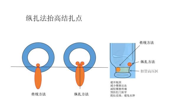 2,久痔不愈少年苦,手术治痔贫血愈,拔出萝卜不带泥