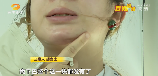 洗牙后悔一辈子，为什么很多人后悔洗牙（长沙一女士洁牙后后悔不已....）