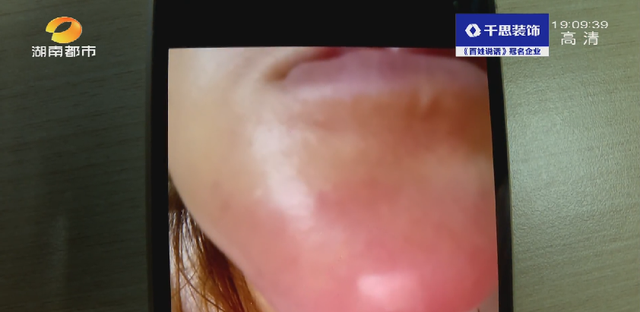 洗牙后悔一辈子，为什么很多人后悔洗牙（长沙一女士洁牙后后悔不已....）