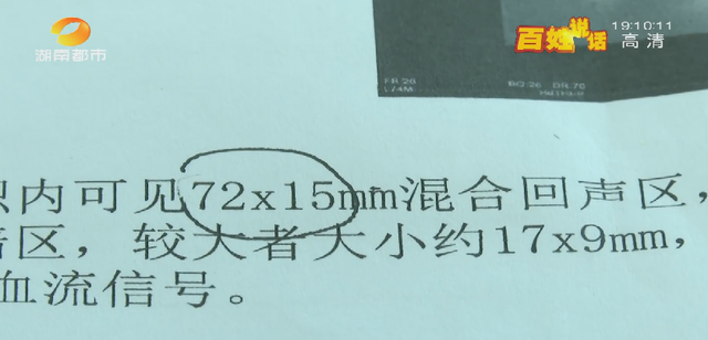 洗牙后悔一辈子，为什么很多人后悔洗牙（长沙一女士洁牙后后悔不已....）