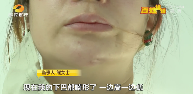 洗牙后悔一辈子，为什么很多人后悔洗牙（长沙一女士洁牙后后悔不已....）
