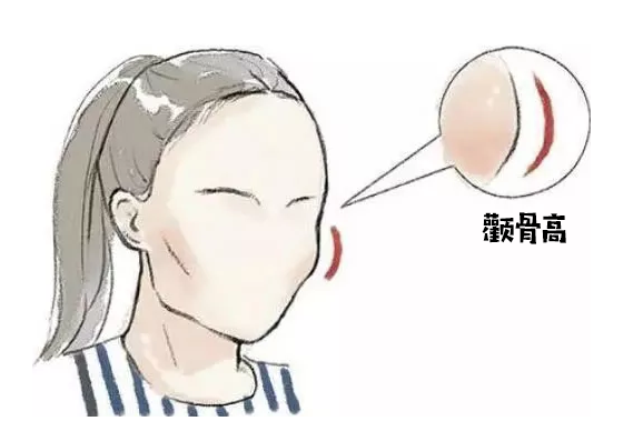 颧骨高怎么才能改善，高颧骨怎么改善（她们的颧骨怎么越来越高了）