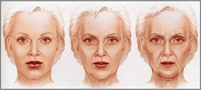 颧骨高怎么才能改善，高颧骨怎么改善（她们的颧骨怎么越来越高了）