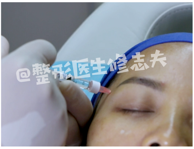 颧骨高怎么才能改善，高颧骨怎么改善（她们的颧骨怎么越来越高了）