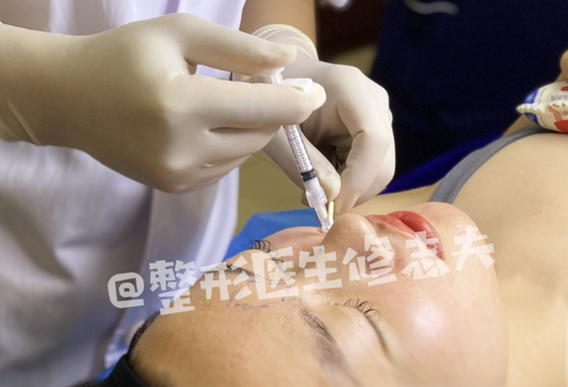 颧骨高怎么才能改善，高颧骨怎么改善（她们的颧骨怎么越来越高了）