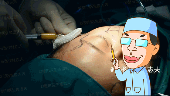 颧骨高怎么才能改善，高颧骨怎么改善（她们的颧骨怎么越来越高了）