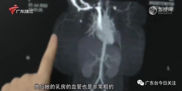 五百克是一斤吗，500克是一斤吗（女子乳房两年内从B杯→Q杯）