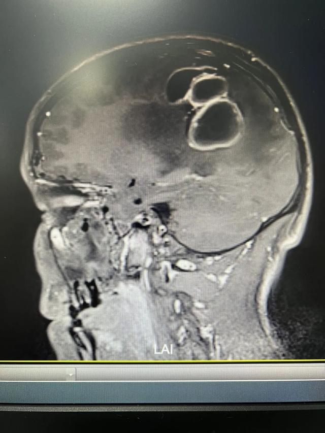 笑杯是什么意思网络用语，掷杯一直笑杯什么意思（小伙来杭州几天撑不住了...病因竟和家里的它有关）