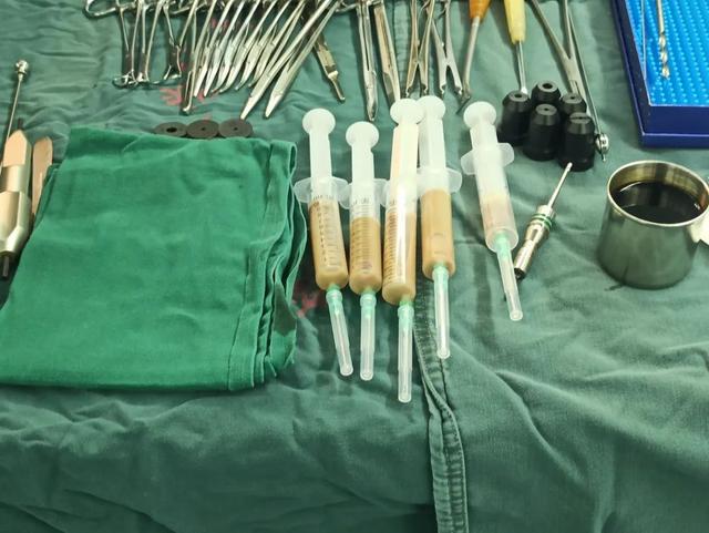 笑杯是什么意思网络用语，掷杯一直笑杯什么意思（小伙来杭州几天撑不住了...病因竟和家里的它有关）