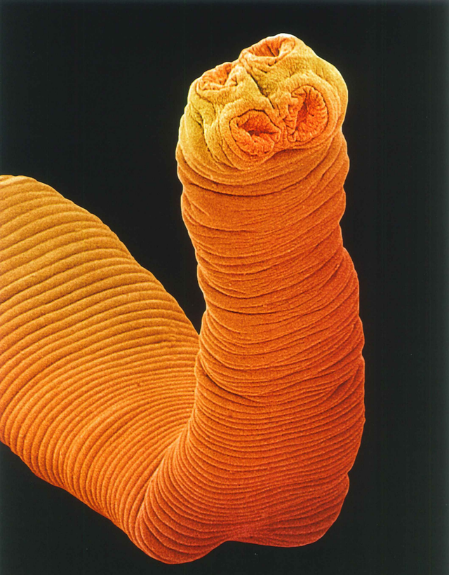 生腌海鲜有寄生虫吗，什么海鲜可以生腌（女子上网学做生腌虾食物中毒）