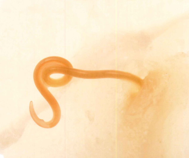 生腌海鲜有寄生虫吗，什么海鲜可以生腌（女子上网学做生腌虾食物中毒）